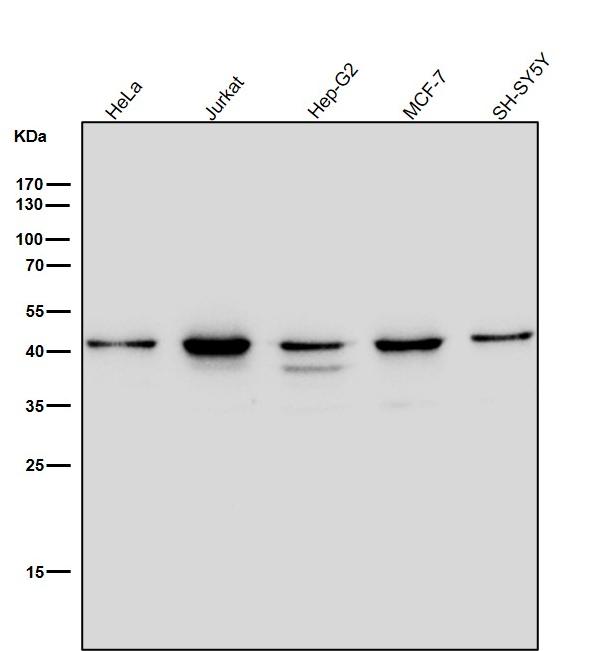 WB - Anti-CKII alpha CSNK2A1 Rabbit Monoclonal Antibody ABO14023